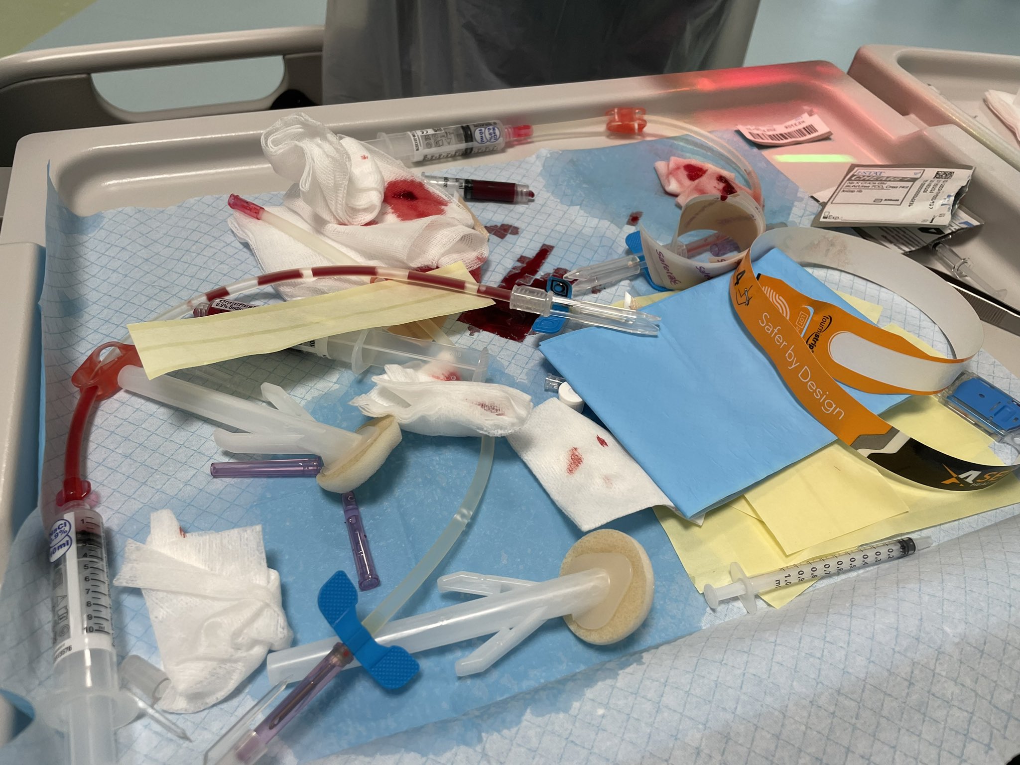 A tray full of used syringes, needles, and other paraphernalia connected with the needling of a fistula for dialysis.
